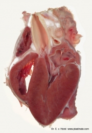 heart_valve_anatomy