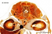 kidney_anatomical_specimen